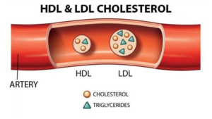 HDL-LDL